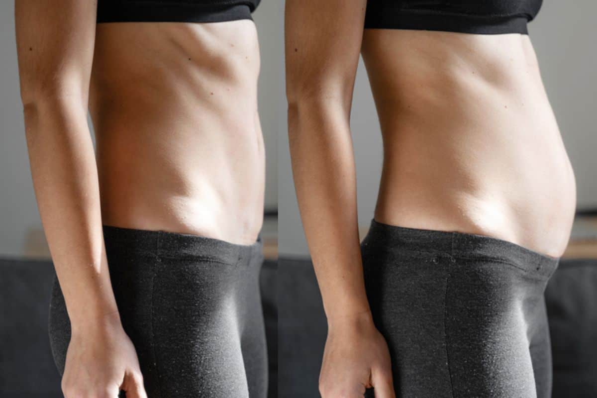 How long does diastasis recti take to improve Warminster?