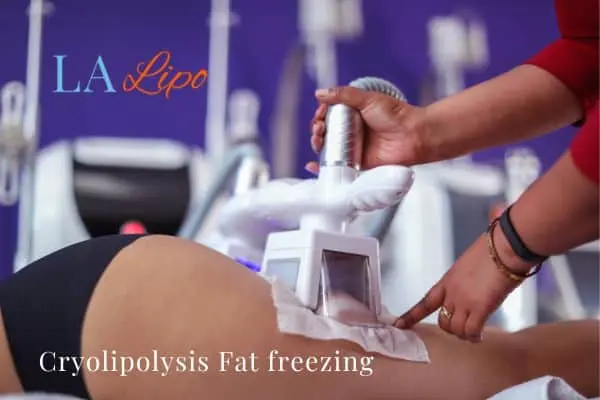 women getting fat freezing Warminster