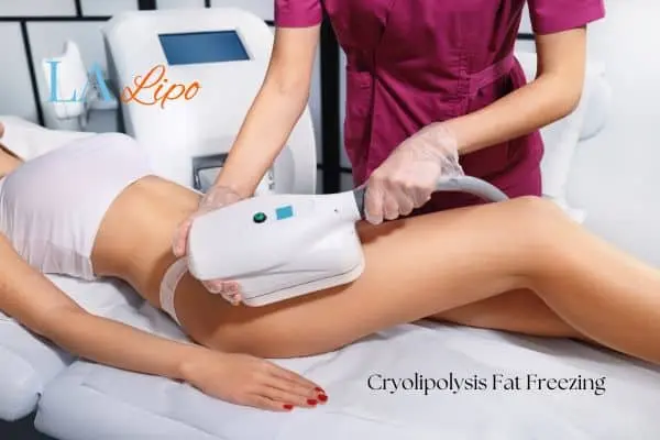 Woman receiving coolsculpting Warminster treatment on her thighs