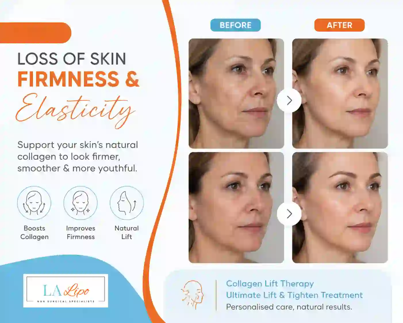 Sign #7: Loss of Skin Firmness and Elasticity Warminster
