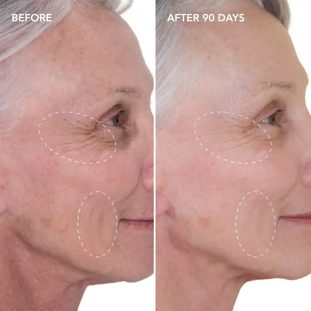 When will you see results Warminster